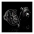Gladen GENERIC 200-MB03 – dedykowane woofery 200 mm do Mercedesa